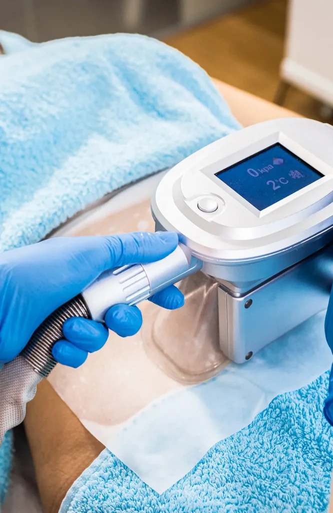 Cryolipolysis in Delémont, Switzerland