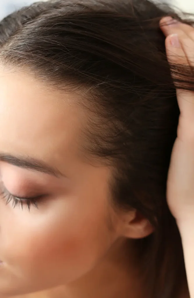 Haartransplantation in Delémont in der Schweiz | Dr. Beck