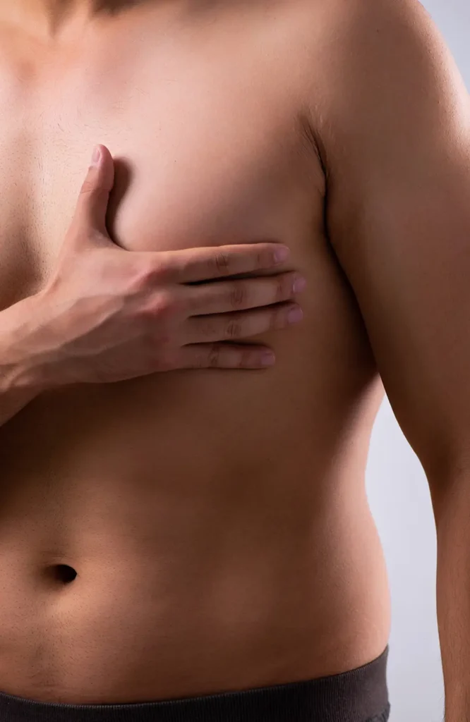 Gynäkomastie in Delémont in der Schweiz | Dr. Beck